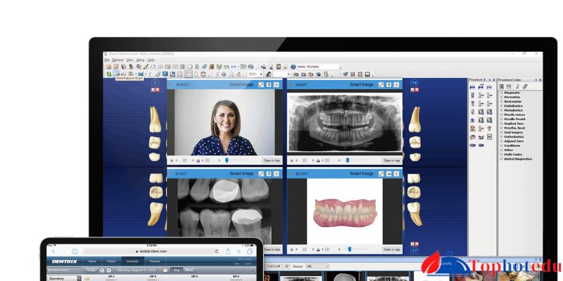 Future Prospects of Dental Practice Management Software